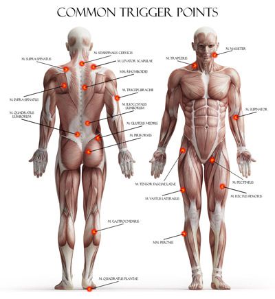 Trigger Point Therapy